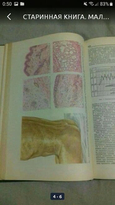 большая медицинская энциклопедия: Старинная книга 
малая медицинская энциклопедия 
1968г. Том 10 — 5