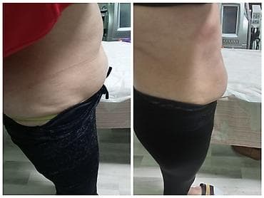 hekim sekli: Estetik xidmətlər: üz və bədən üçün qeyri‑invaziv kontur formalaşdırma — 3