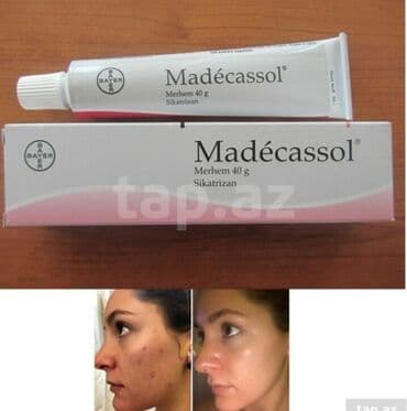 крем барои сафед кардани кус: Крем для лица, Для склонной к акне кожи, 40 мл, Платная доставка — 1