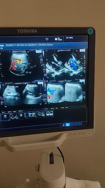 Toshiba Aplio 500 crystal seri ultrasəs aparatı - Yüksək — 3