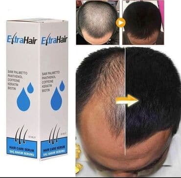 wow sac serumu: Saç üçün yağ, Saç tökülməsinə qarşı, Yeni, Pulsuz çatdırılma — 1