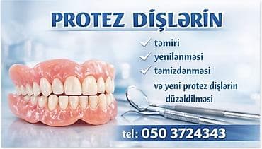 Услуги по строительству и ремонту: Protez dişlər üzrə peşəkar xidmətlər: - Protez dişlərin təmiri - — 1
