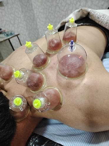 ərəb dili: Xidmətlərimiz: Hicama (steril, 1 dəfəlik ləvazimatlarla) — 2