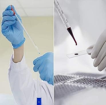 pipet: ﻿Şüşə pipet (pipetka) Laboratoriya üçün maye damcılayıcı. Şkalalı — 4