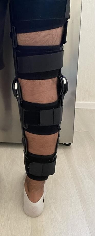 Tənzimlənən diz ortozu (immobilayzer) Özüm üçün almışam. Cəmi 1 ay — 3