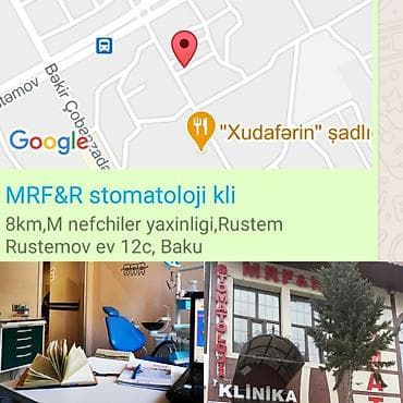 акция на установку брекетов: İnstaqram dr.zerif). Seçilən pasientlerə sonda kappa hədiyyə — 8