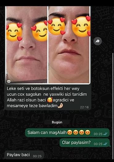 Ləkə dəsti və “botoks effekti” verən üz baxımı - Məqsəd: üz