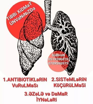 bioloji yaşam sağlamlıq mərkəzi: Digər xəstəliyin müalicəsi, Evə gəlməklə — 4