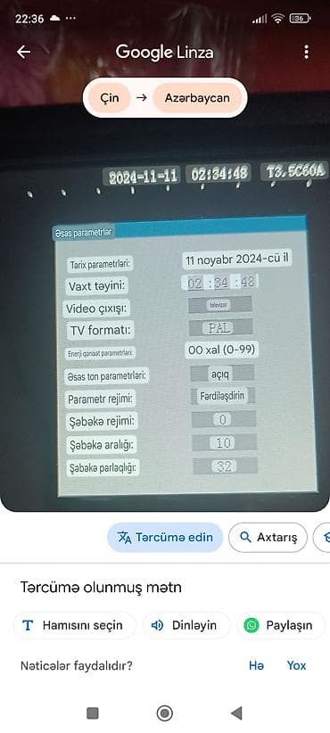 Tibbi avadanlıq: Rəqəmsal ultrasəs/USG görüntüləmə cihazı üçün portativ monitor və — 4