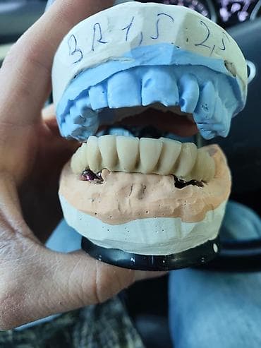Услуги: Diş texnikliyi kursları(6 ay erzinde tam öyredilir, stomotoloji — 8