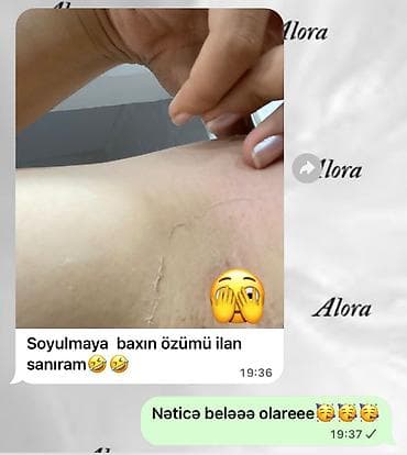 ayaqlar: Güclü pilinq effekti verən bədən üçün soyulma maskası/kremləri - Ölü — 1