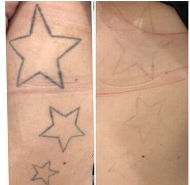 qaş formaları 2022: Salam.Qas Permanent,Microblading,Tatu yazilmasi ve silinmesi,Sac — 4