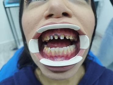 Услуги: Diş texnikliyi kursları(6 ay erzinde tam öyredilir, stomotoloji — 10