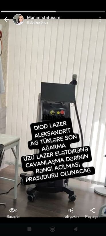 sari tukler ucun lazer: DIOD Lazer Aleksandrit Ağ tüklər üçün elektron epilyasiya AGARMA — 1