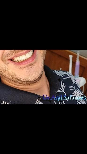 Ремонт техники: Stomatolojı Klinika Dentalux– təbii görünüşlü, parlaq gülümsəmə - — 6