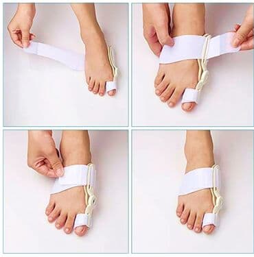 padaqra ucun silikon: Padaqranı mualice eden ve agrinin qarşisini alan fiksator. Silikon — 7