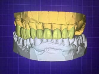 qaynaq saclarin qiymeti: Услуга зубного техника и зуботехнической лаборатории выполняю все — 4