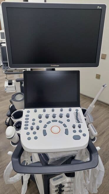 usm aparati: USM aparatı, Uzi aparatı İnnovativ texnologiya sayəsində sadə — 3