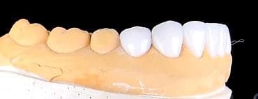 Paltar tikişi: Salam hörmətli və dəyərli Diş Həkimlərimiz.mən diş Texnikiyem.Bakının — 9