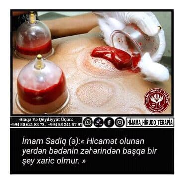 bioloji yaşam sağlamlıq mərkəzi: 📌Hi̇cama nədi̇r❓ 🔷️qanalma ilə müalicə üsulu olaraq. Xəstəliklərə — 4