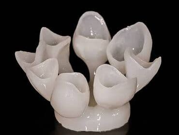 bakida tibbi masaj kurslari: Keramika sobası. Press keramika sobası. Sirio luxor. Tam işlək — 2