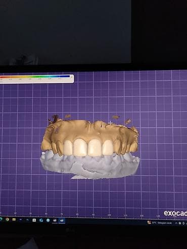 İstehsal avadanlığı: EXOCAD 3.3 9512 – diş texnologiyaları üçün CAD proqramı - Dişlərin — 4