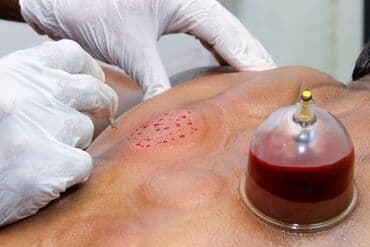 услуги по уходу за больными на дому: Hicama, zəli — 3