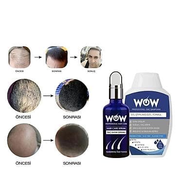 Косметика: Wow Saç çixaran serum Saç tökülməsinin qarşısını almaq və yeni — 1