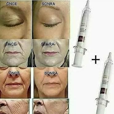 8 mart gulleri: Uze qulluq vasiteleri.Her biri muxtelif qiymetedi — 2