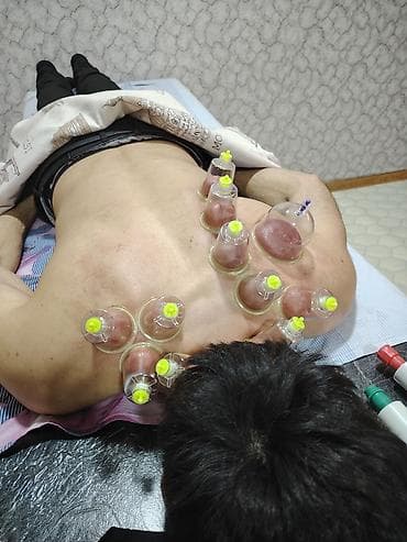 ərəb dili: Xidmətlərimiz: Hicama (steril, 1 dəfəlik ləvazimatlarla) — 1