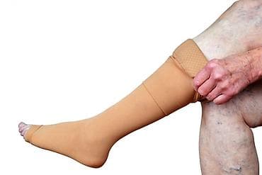 devalt lazer: Varikoz müalicəsi, Klinikada — 3