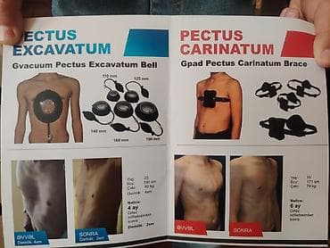 samsunq a 14: Virtual reallıq (VR) qulaqlıqları üçün nəzərdə tutulmuş bu baş kəməri — 9