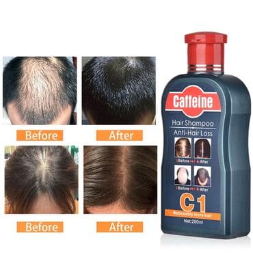 homm bitkisel az: Saç tökülməyinə qarşı
Saç gətirən şampun — 1