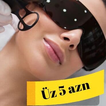 diod lazer aparatı: Epilyasiya üçün, Karbon pilinq, Tatto silmə, Aleksandrit, Təlim keçirilir — 1