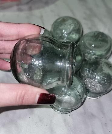 tipsi ile dirnaq qaynagi nedir: Şüşə bankalar – vakuum fincanları (cupping) dəsti - Material: qalın — 3