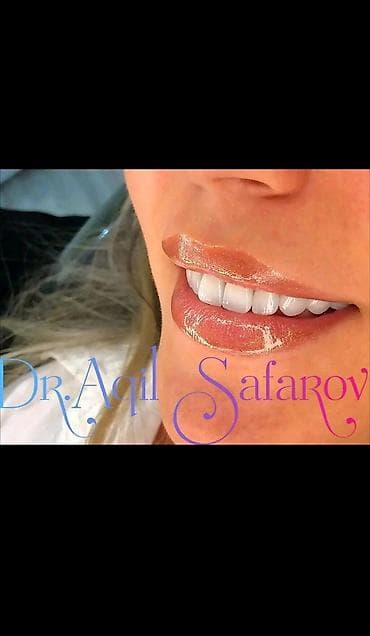 Ремонт техники: Stomatolojı Klinika Dentalux– təbii görünüşlü, parlaq gülümsəmə - — 2