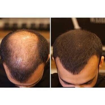 saç satışı: Saç düzümü üçün vasitələr, Hər növ saçlar üçün, Yeni, Pulsuz çatdırılma — 1