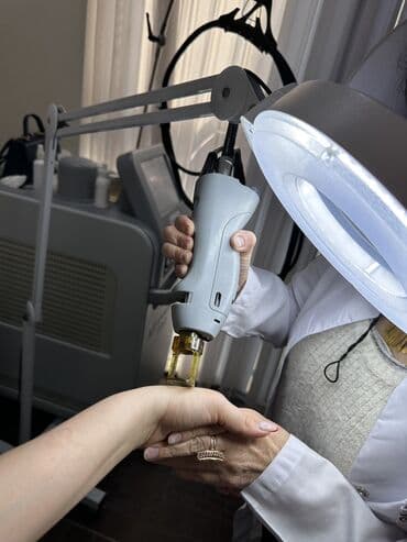 lazer kəsim aparatı: Lazer aparatları — 4