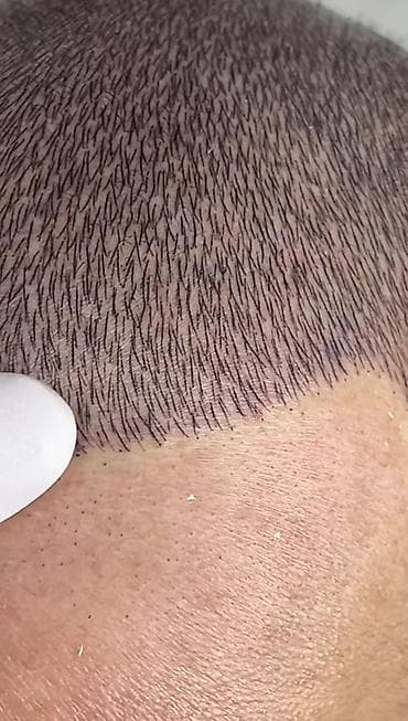 xidmət: Tatto nökte atişiylariyla tük effekti yaradib keçelliyi örten — 4