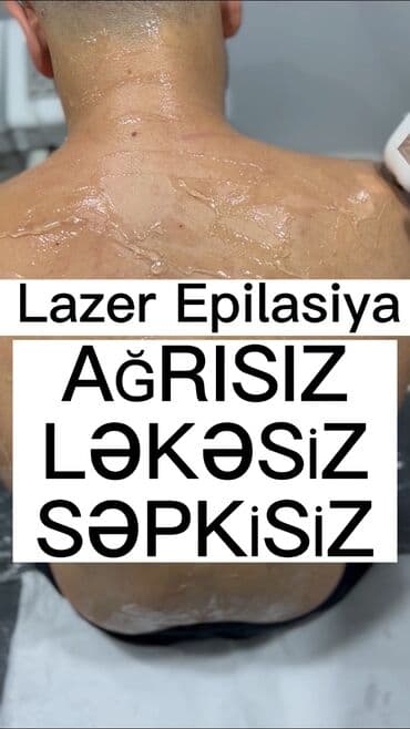 sari tukler ucun lazer: Kişilər üçün Lazer Epilasiya✅ Üz,Boyun,Boğaz,Qulaq,Burun = 10 AZN — 2