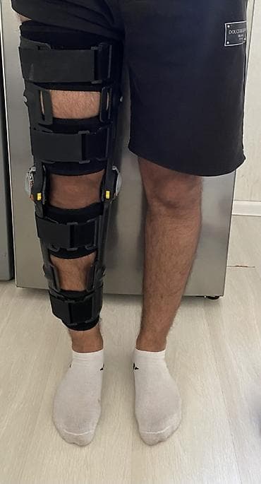 Tənzimlənən diz ortozu (immobilayzer) Özüm üçün almışam. Cəmi 1 ay — 2