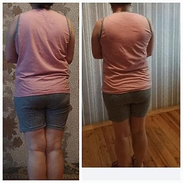 gozelik salon: Xidmət: fərdi arıqlama və bədənformalaşdırma proqramı Təsvir: - Foto — 2