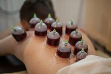 zeli: Xicama (qanın vakuumla çıxarılması) xidməti - Klassik və nöqtəvi — 1