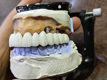 Услуги: Diş texnikliyi kursları(6 ay erzinde tam öyredilir, stomotoloji — 1