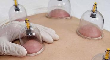 koyneye sekil vurmaq: Masaj xidməti -peşakər ustalarla 💆‍♂️💆‍♀️👶 ​Sağlamlığınızın qayğısına — 2