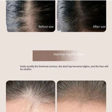 королевский боб для похудения оригинал и подделка: 🩷🩷Saç pudrası 🔴🔴keçəl yerləri tük az olan yerləri doldurmaq üçün pudra — 2