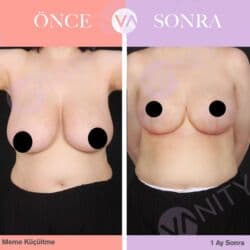 qarin eritmek ucun krem: Estetik–plastik cərrahiyyə və bədən formalaşdırma xidmətləri Təklif — 18