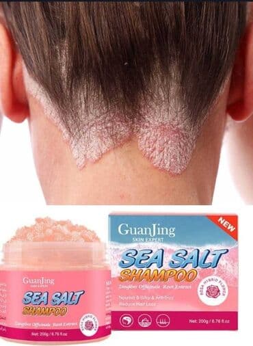 sac tokulmesine qarsi sabun: 🔥Sea Salt Psoriaz əleyhinə 🔥Dəniz duzu Sampun 🔥Bitki mənşəli şampunu — 1