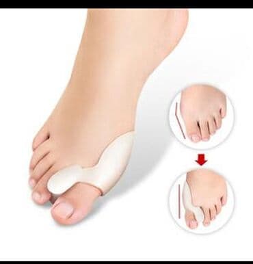 padaqra ucun silikon: Padaqranı mualice eden ve agrinin qarşisini alan fiksator. Silikon — 4