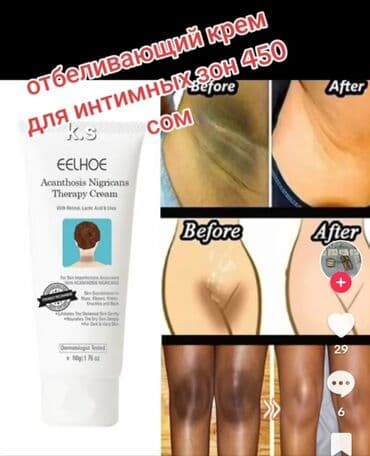 şirkətdən online satış: Eelhoe firmasının supper ağardıcı krem #bikini ağardıcı #qolaltı